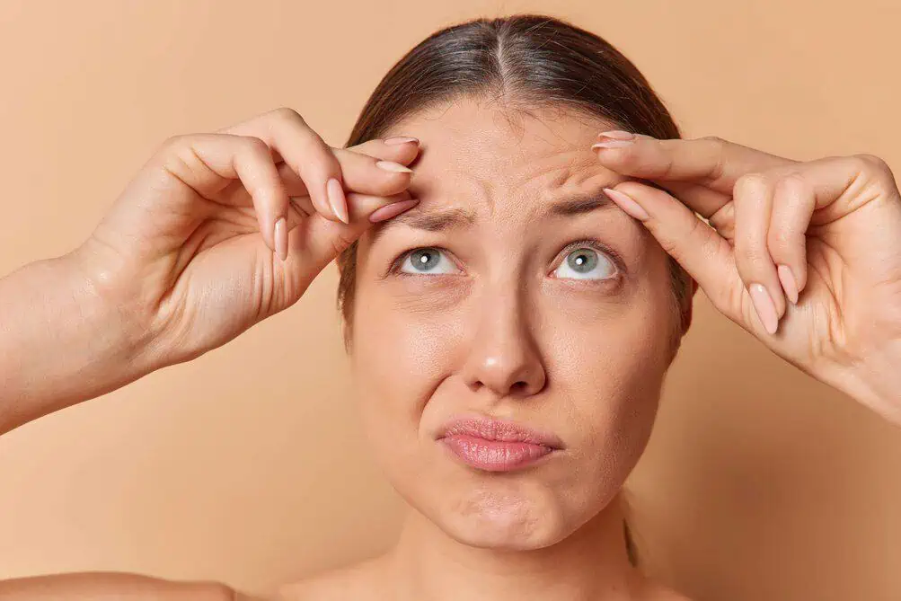Do You Worry about the Growing Deeper Creases Around the Mouth and Chin? Let’s Probe Their Occurrence and Correction Methods!