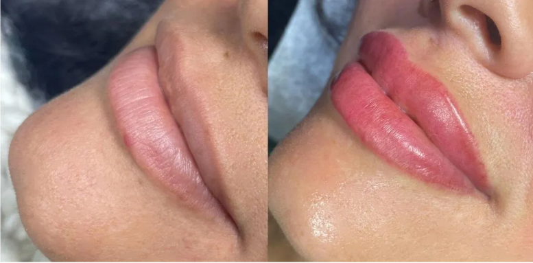 Managing Swelling After a Permanent Makeup Procedure